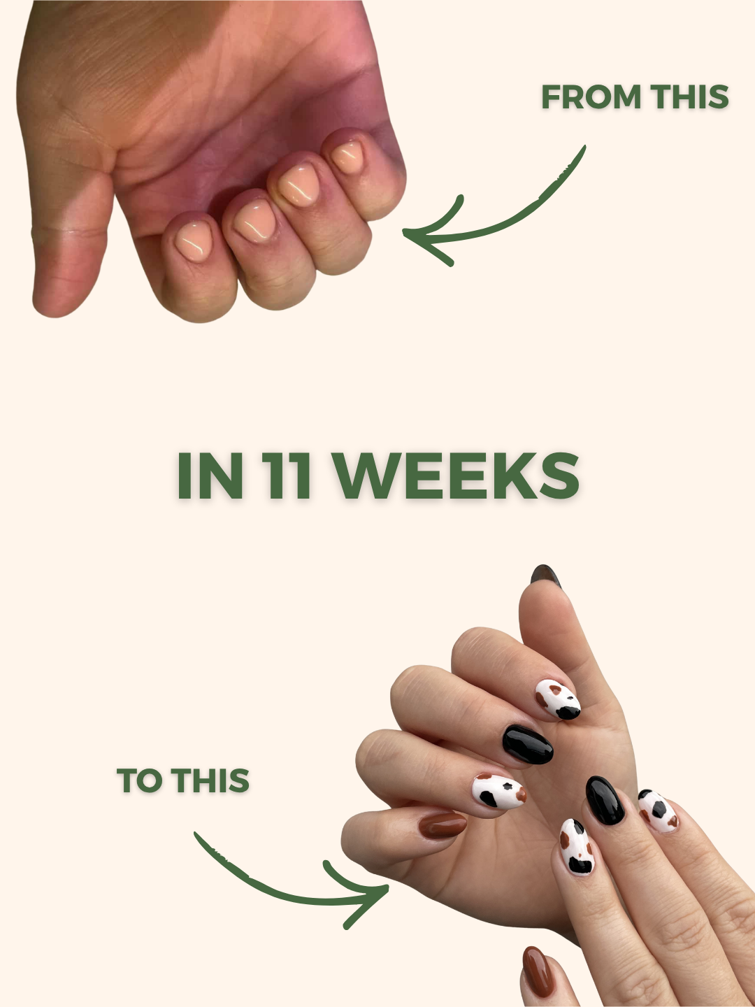 Nail Rehab Program
